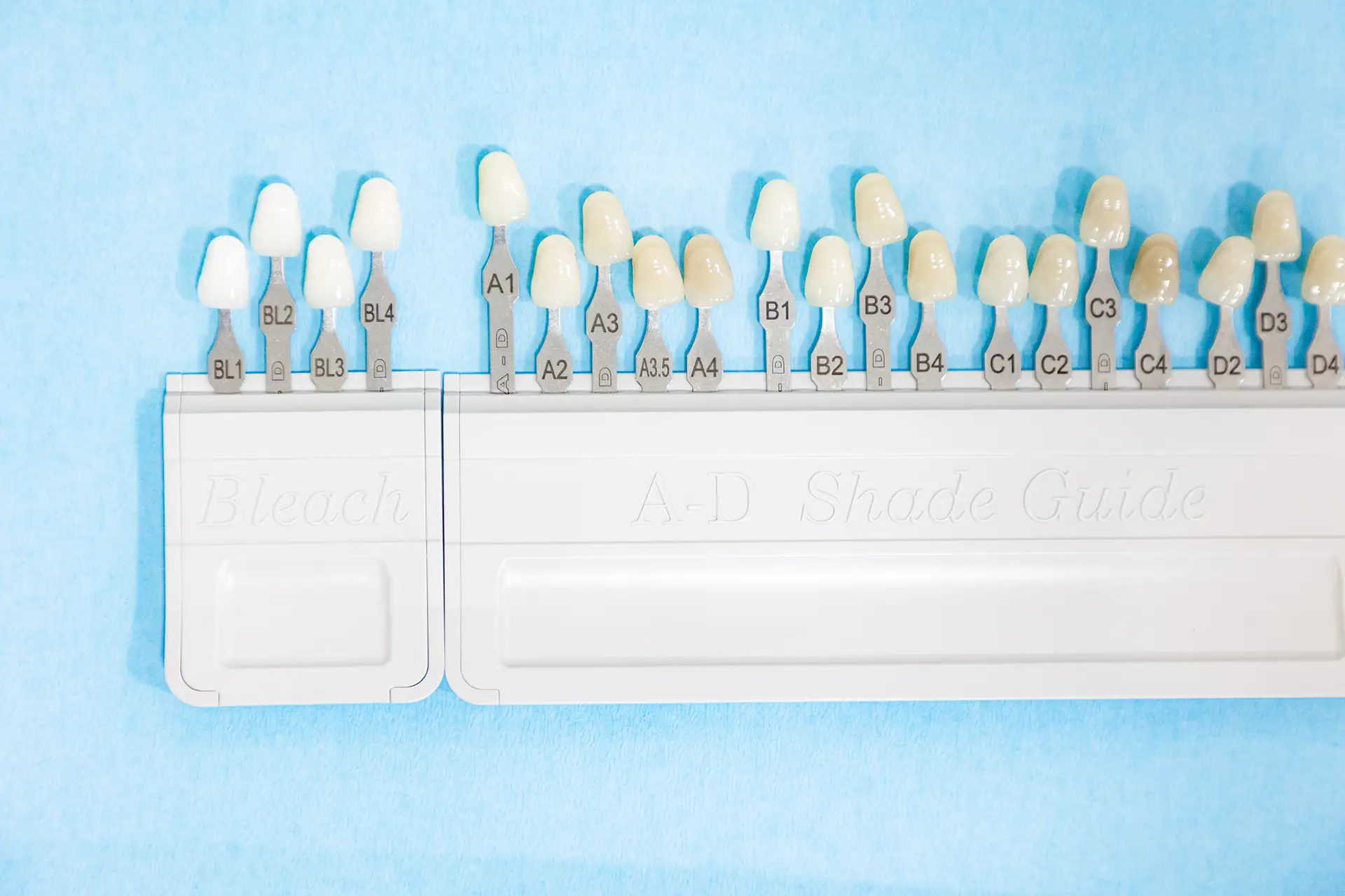 que edad es mejor para las carillas dentales