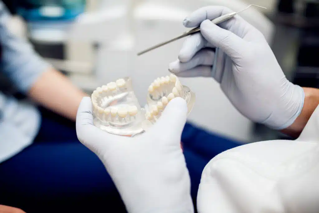 Implantes Dentales Sin Tornillo
